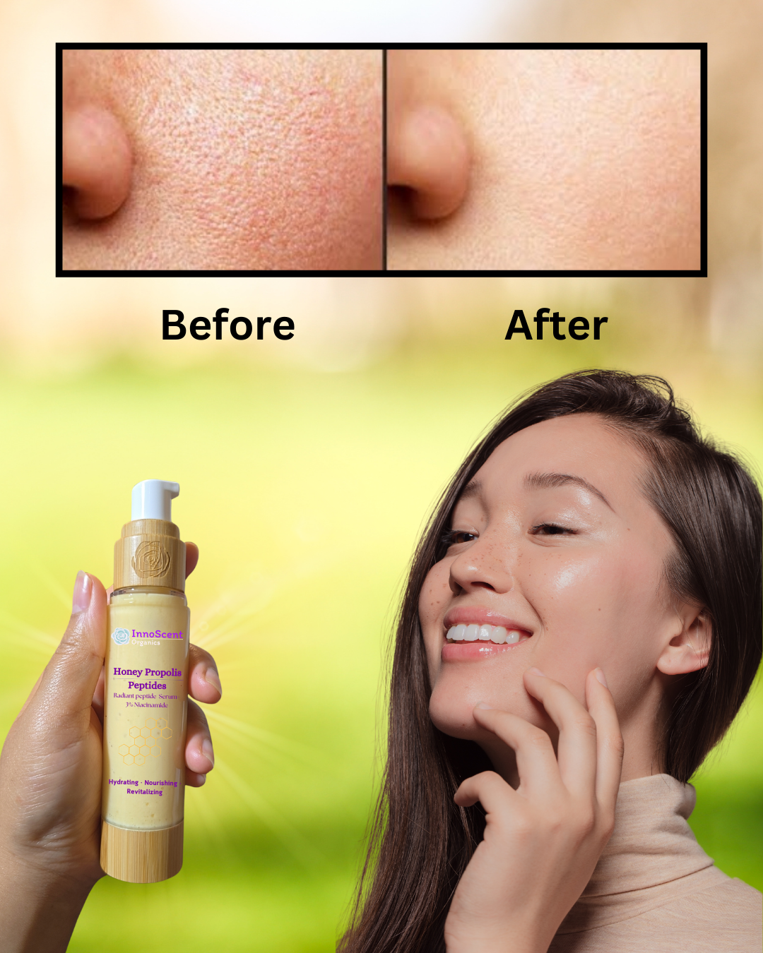 A woman standing outside, gently touching her face, radiating happiness after using Honey Bee Propolis peptide Serum. The before and after image highlights the serum's transformative effect, showcasing smoother, glowing skin with a natural, healthy radiance.